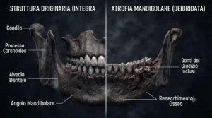 Conseguenze dell'ibridazione, mascella