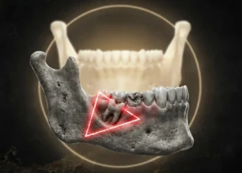 Il dente del giudizio smentisce l’evoluzione